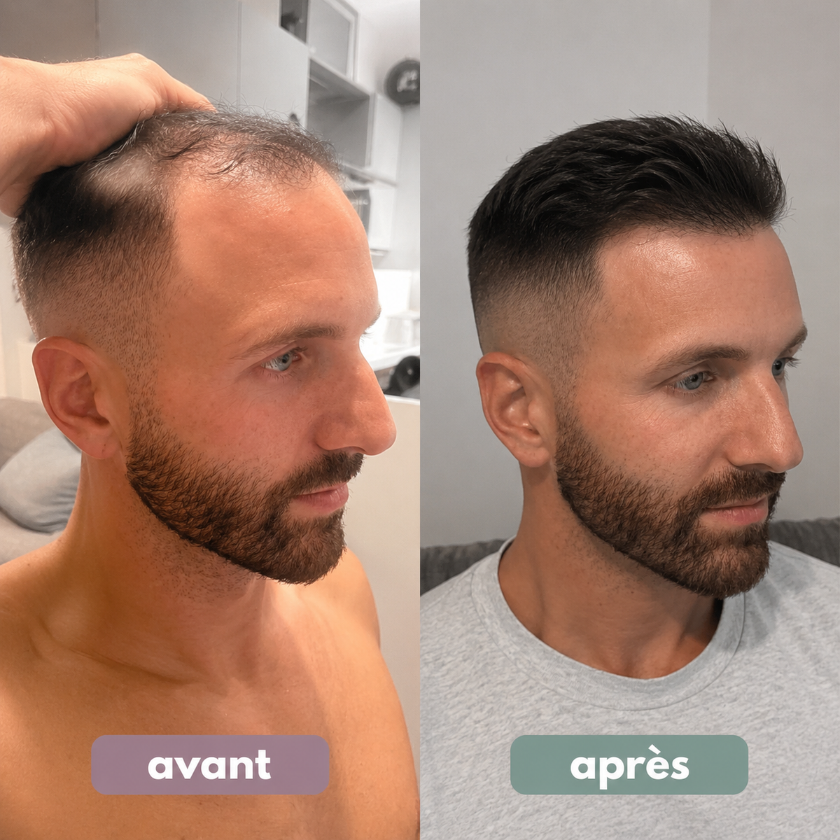 Sérum roll-on pour la pousse des cheveux