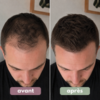 Sérum roll-on pour la pousse des cheveux