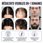 Sérum roll-on pour la pousse des cheveux