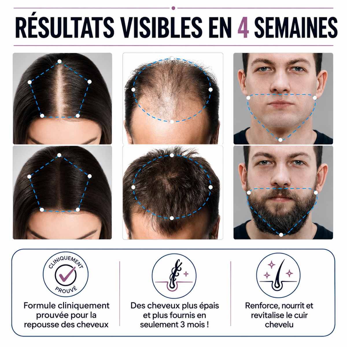 Sérum roll-on pour la pousse des cheveux